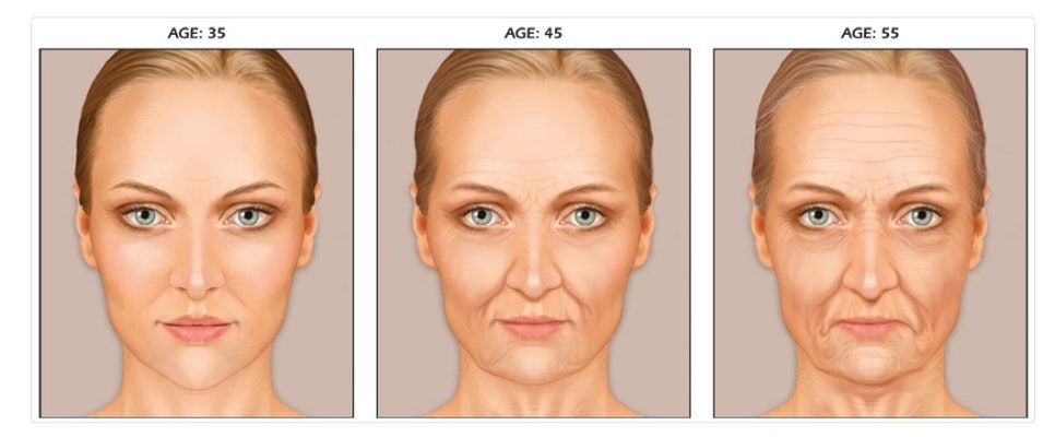 안면거상 수술의 적절한 시기: 얻는 것과 감수해야 할 것 관련 이미지 1