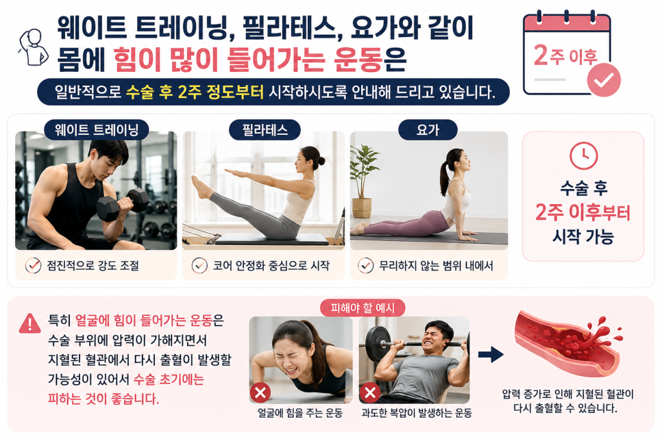 윤곽수술 후 운동은 언제부터 가능할까요? 회복 기간별 주의사항 관련 이미지 2