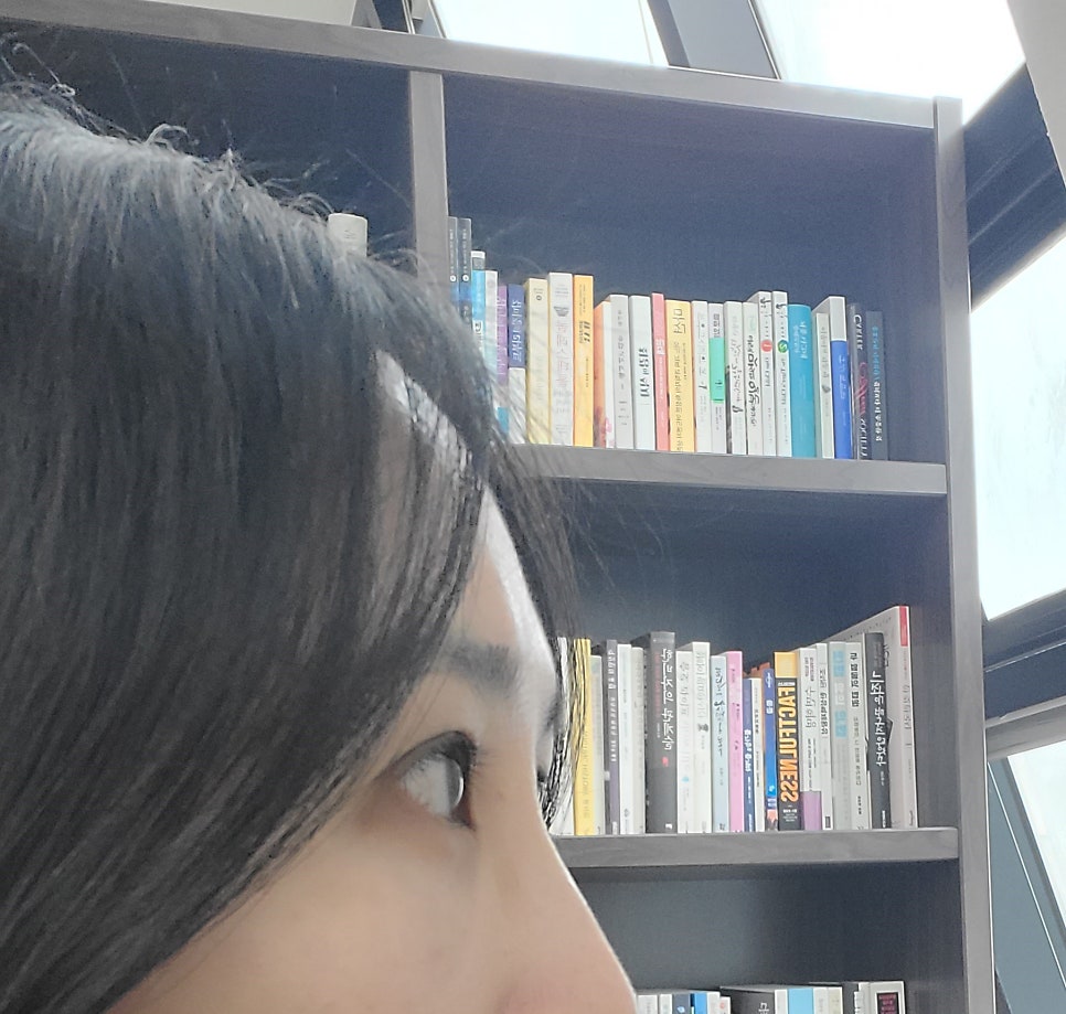 3D프린터 보형물을 이용한 안구함몰, 함몰눈 교정의 실제 사례 관련 이미지 10