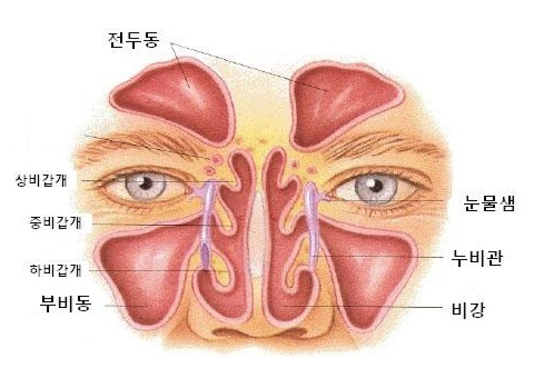 A Complete Summary of 6 Complications After Cheekbone Surgery: Sinusitis, Recurrence, Hollow Cheeks, and Sagging Cheeks image 13