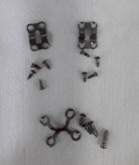 Is It Necessary to Remove the Fixation Pins After Facial Contouring Surgery? image 3