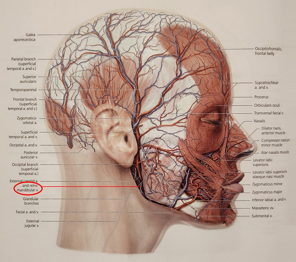 What kinds of massive bleeding can occur during facial contouring surgery? image 2