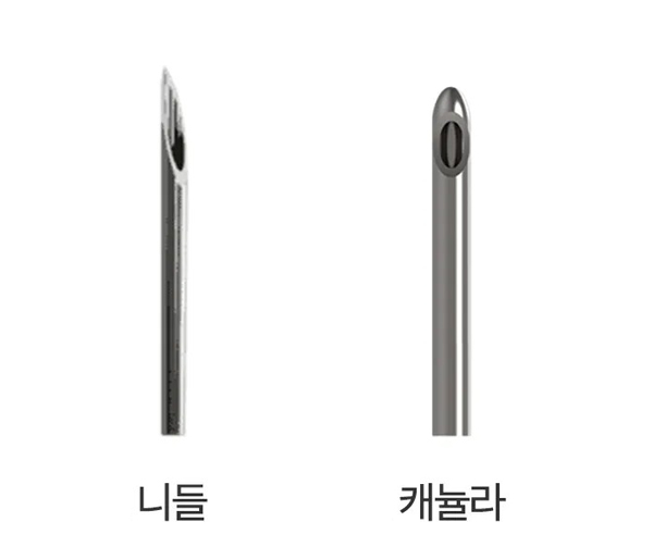 이중턱 수술 단계별 정리 - 지방흡입부터 이중턱 근육묶기까지 관련 이미지 3