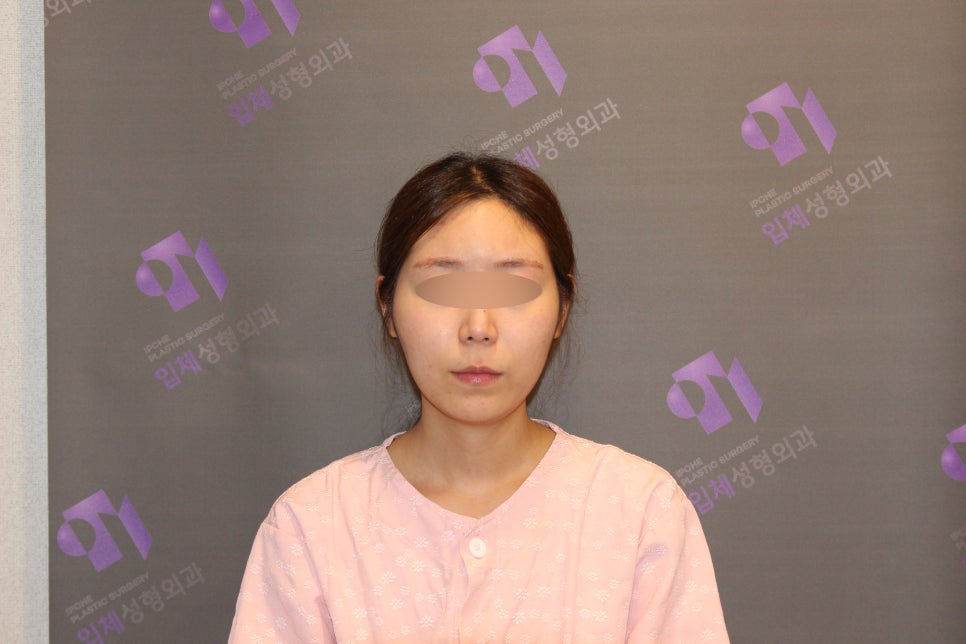 안면윤곽수술비용, 비쌀수록 좋은걸까요? -전문의가 알려드립니다. 관련 이미지 3