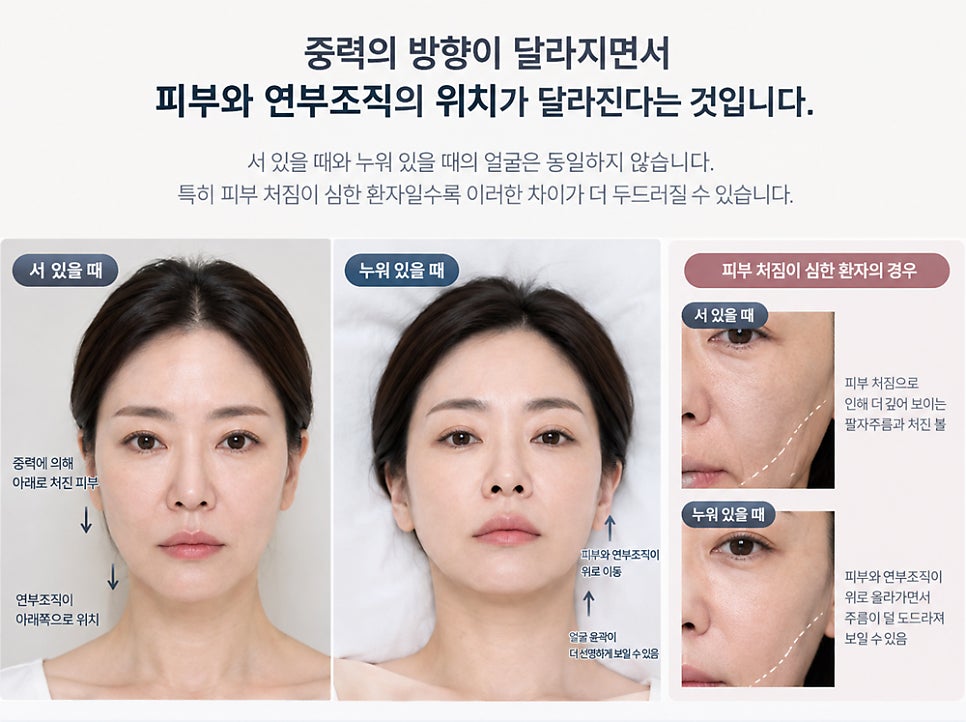 안면거상 수술 시간은 얼마나 걸릴까? 수술 과정별로 자세히 알아보겠습니다. 관련 이미지 2