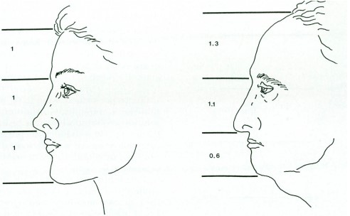 The Hidden History of Forehead Reduction Surgery &ndash; From Wong Fei-hung to Hair Transplantation and Modern Aesthetics image 6