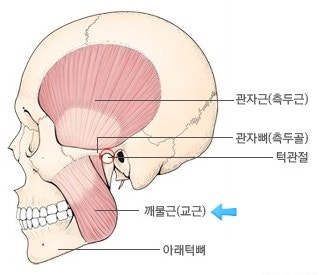 Is masseter muscle resection really necessary for square jaw reduction? image 1