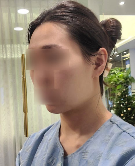 If you’re like this, don’t get contouring surgery!! An absolute no-go face? image 5