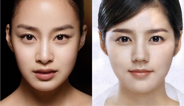 안면윤곽, 많이 가져오는 연예인 사진은? 관련 이미지 1