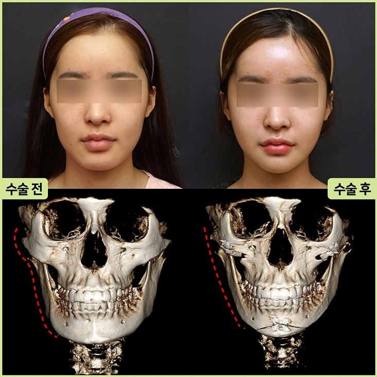 Facial Contouring, a Place That Does It Safely and Properly image 1