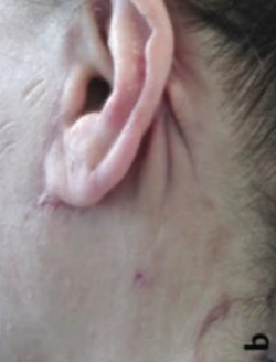 Is it possible to do a mini neck lift on its own? image 3