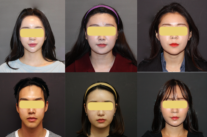 Facial Contouring, a Place That Does It Safely and Properly image 3