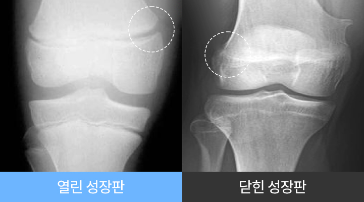 미성년자도 윤곽수술을 할 수 있나요? 관련 이미지 2