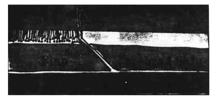 The Hidden History of Forehead Reduction Surgery &ndash; From Wong Fei-hung to Hair Transplantation and Modern Aesthetics image 4