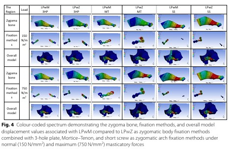 [Paper Review] What Matters More in Zygoma Reduction Than Double or Triple Fixation image 7