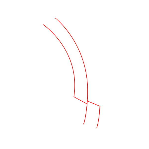 Back Cheekbone Shaving? Osteotomy? Do You Really Need It? image 7