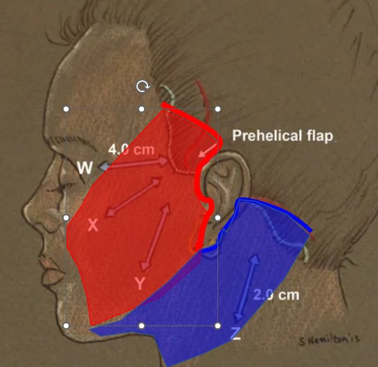 Is it possible to do a mini neck lift on its own? image 6