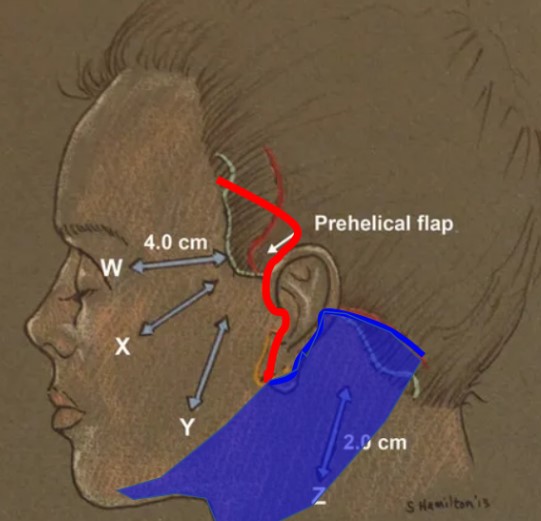 Is it possible to do a mini neck lift on its own? image 4