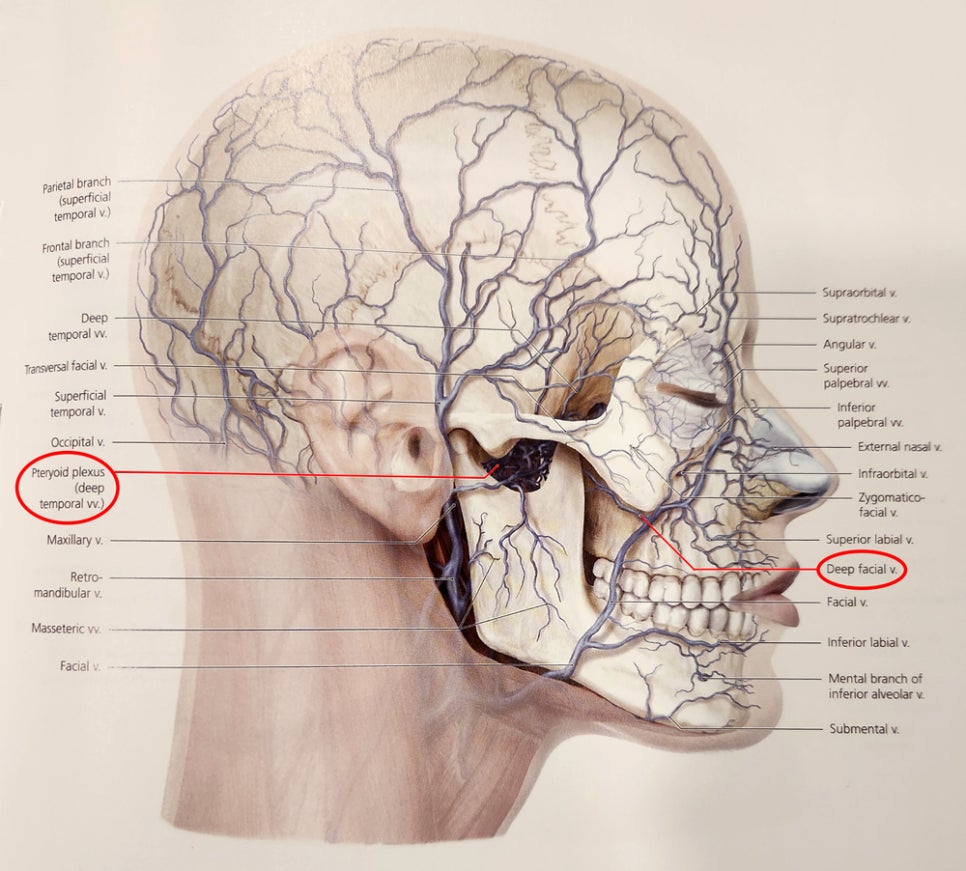 What kinds of massive bleeding can occur during facial contouring surgery? image 1