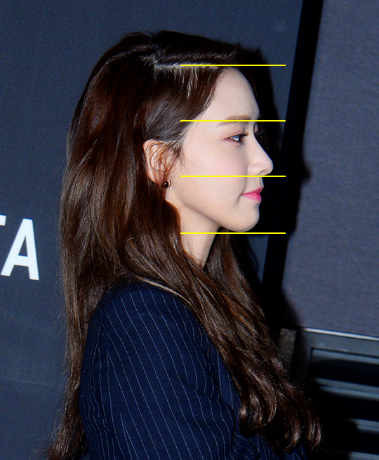 Will Celebrities with a Long Midface Really Not Look Pretty? image 3