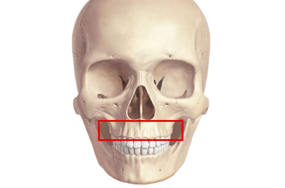 Long Chin, Long Face Contouring - Cases That Do Not Require Double Jaw Surgery image 2