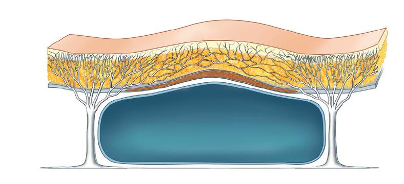 Is it true that cheekbone surgery causes an Indian wrinkle? image 5