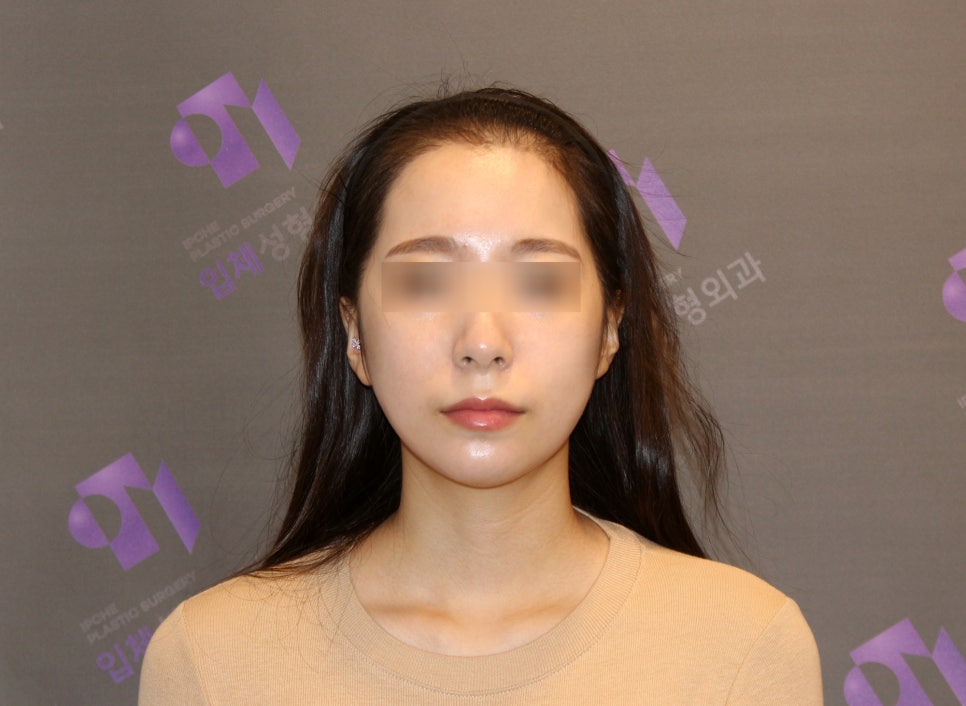 안면윤곽 연예인 고윤정, 카리나 얼굴형처럼 예뻐질 수 있을까요? 관련 이미지 3