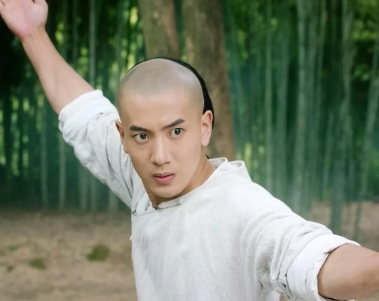 The Hidden History of Forehead Reduction Surgery &ndash; From Wong Fei-hung to Hair Transplantation and Modern Aesthetics image 1