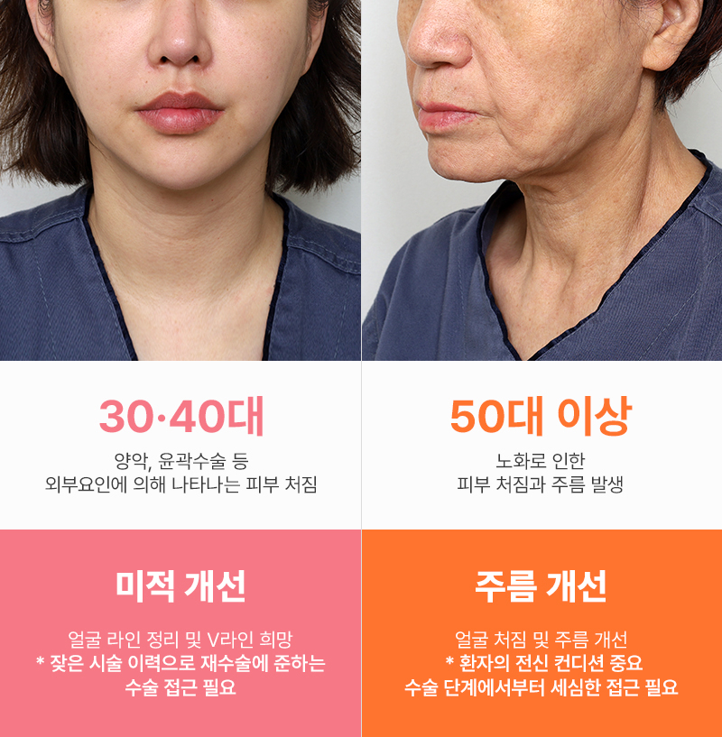 안면거상술을 고민하는 연령대별 특징 관련 이미지 1