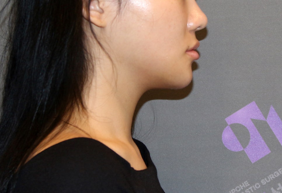 쉐이빙할 수 있는 부위와 효과는 어느정도 되나요? 관련 이미지 10