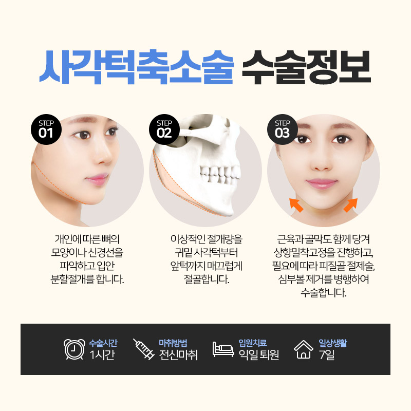안면윤곽수술, 처음부터 끝까지 A to Z 관련 이미지 4