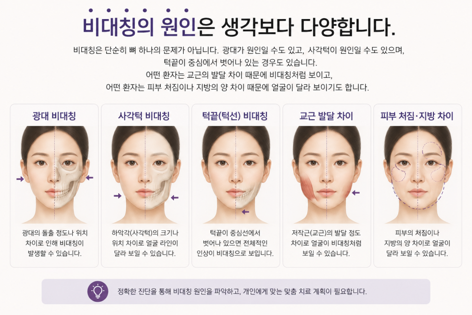 얼굴 비대칭, 한쪽만 윤곽수술 할 수 있나요? 관련 이미지 10