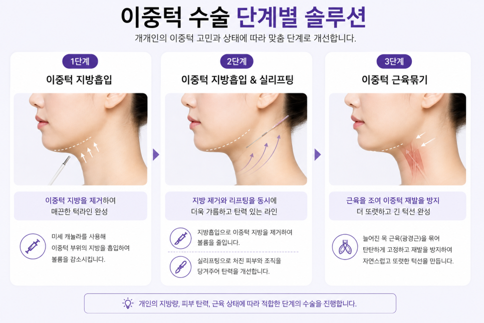 이중턱 수술 단계별 정리 - 지방흡입부터 이중턱 근육묶기까지 관련 이미지 2