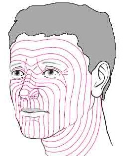Key Techniques in Forehead Reduction Surgery - Trichophytic and W-Plasty Incisions image 3