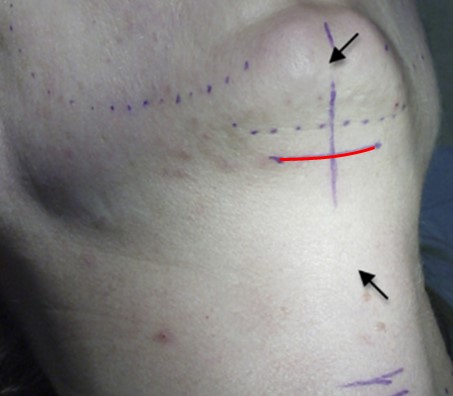 Is it possible to do a mini neck lift on its own? image 7