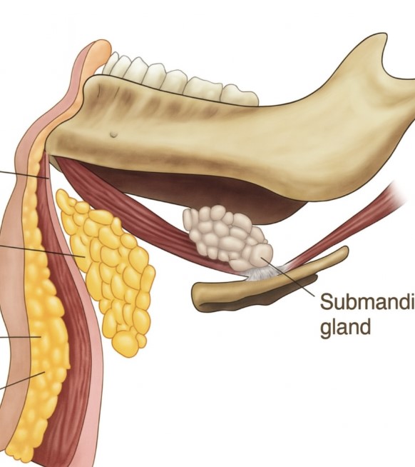 A Complete Guide to Submental Lift Surgery: A New Approach to Solving a Double Chin image 1