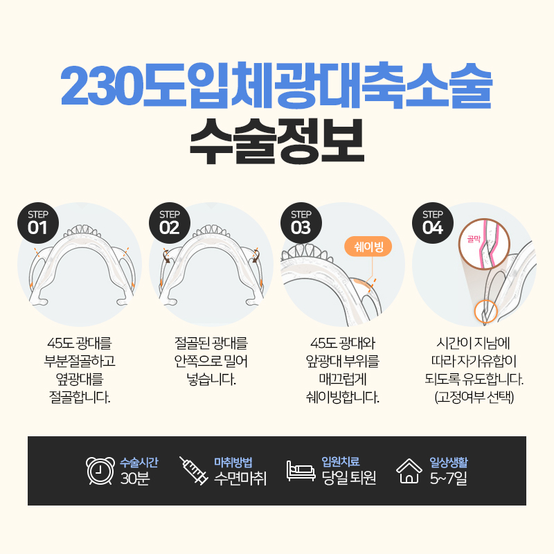 안면윤곽수술, 처음부터 끝까지 A to Z 관련 이미지 7