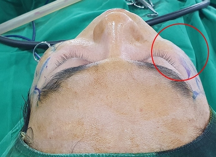 사례로 알아보는 45도광대 쉐이빙효과 분석 관련 이미지 1