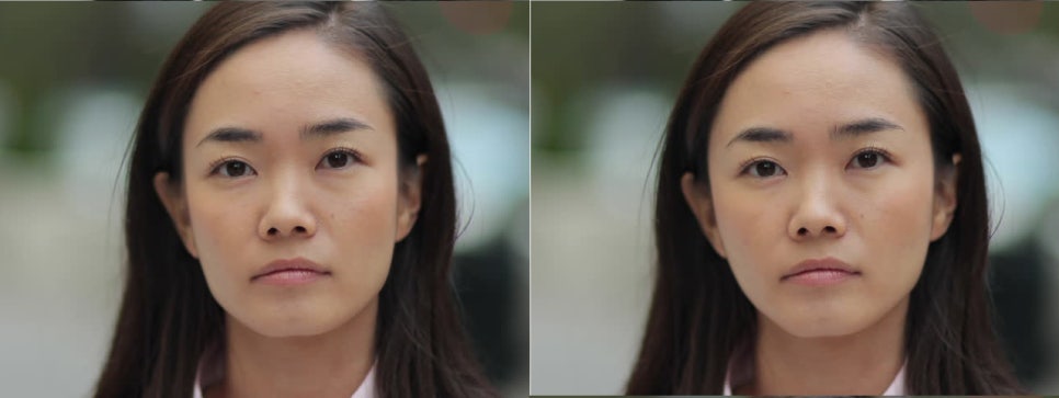 안면윤곽수술, 강남형 얼굴 피하는 법 관련 이미지 3