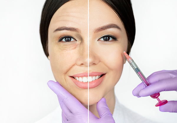 The Botox Effects We Know Aren’t All There Is image 4