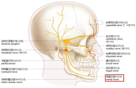 안면윤곽수술 후 신경손상 어떤 것이 있을까요? 관련 이미지 2