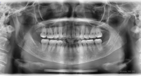Consultation and Design Before Facial Contouring Surgery image 8