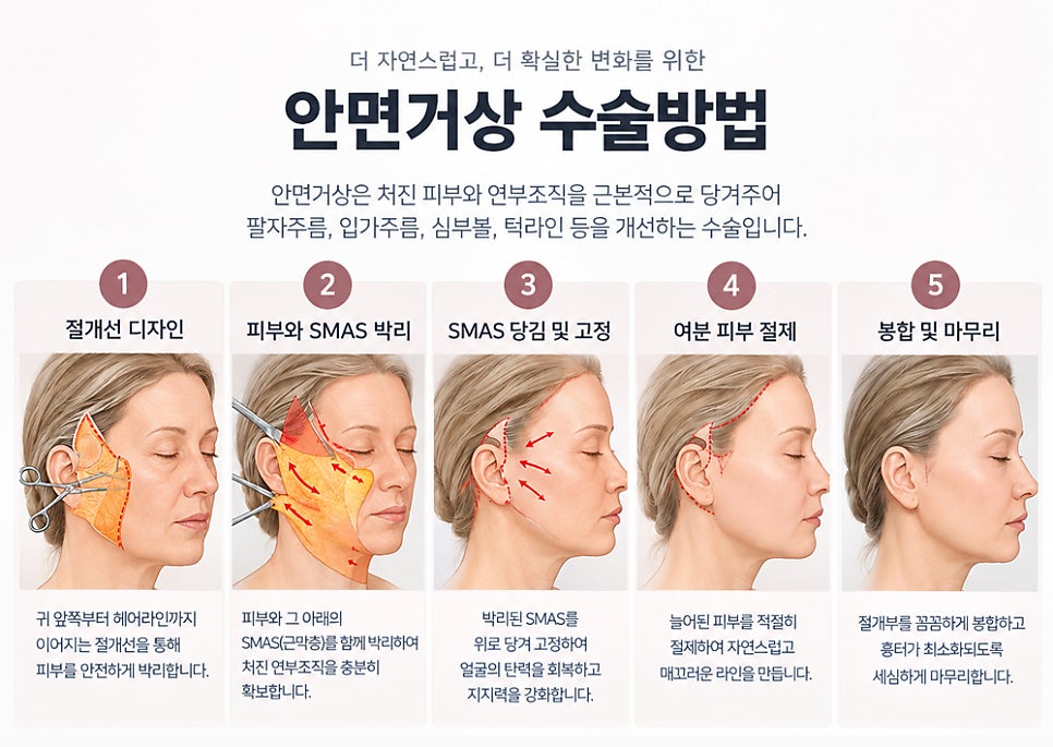 안면거상 수술 시간은 얼마나 걸릴까? 수술 과정별로 자세히 알아보겠습니다. 관련 이미지 3