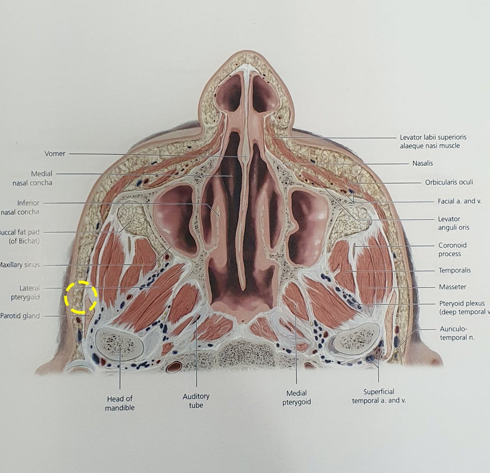 Sunken Cheeks!? It’s Not a Side Effect of Zygoma Surgery! image 7
