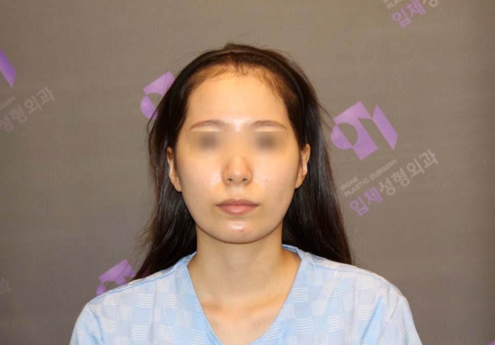 안면윤곽 연예인 고윤정, 카리나 얼굴형처럼 예뻐질 수 있을까요? 관련 이미지 1