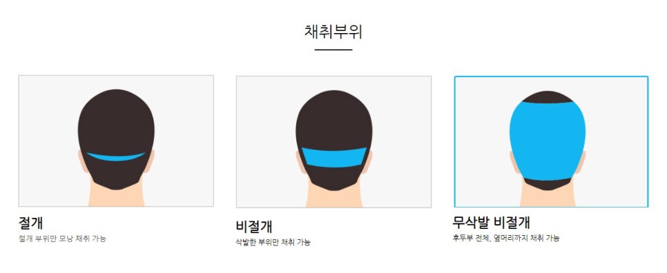 얼굴비율에 맞지 않는 넓은 이마는 어떻게 해결해야 할까요? 관련 이미지 2