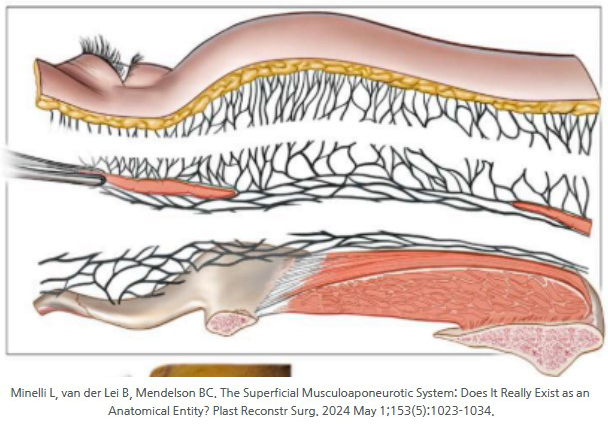 Facelift Q&A (1): The Truth and Myth of the SMAS Fascia image 4