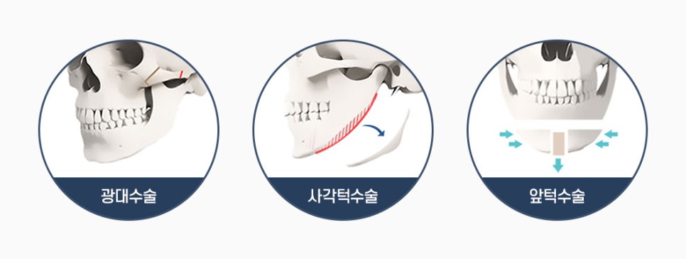 What Are Contouring 3, 4, and 5 Procedures, and Which Surgery Should I Have? image 2