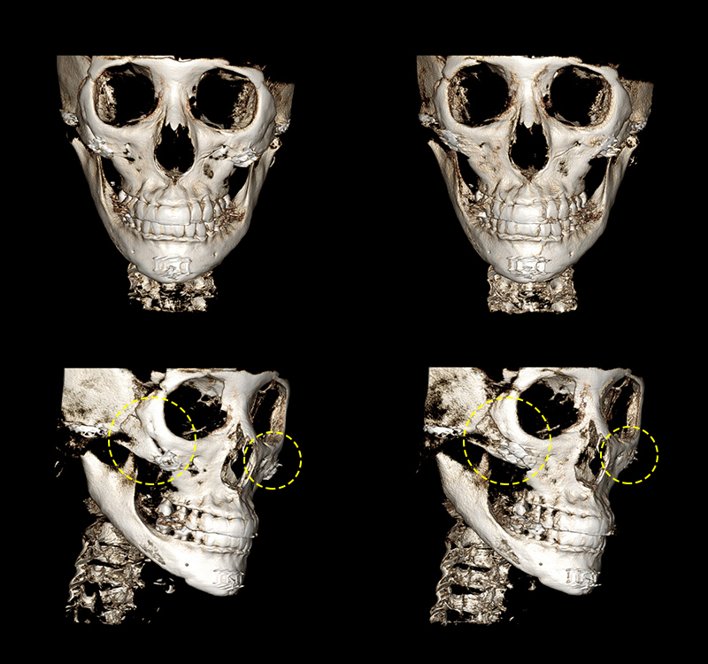 If you’re like this, don’t get contouring surgery!! An absolute no-go face? image 3