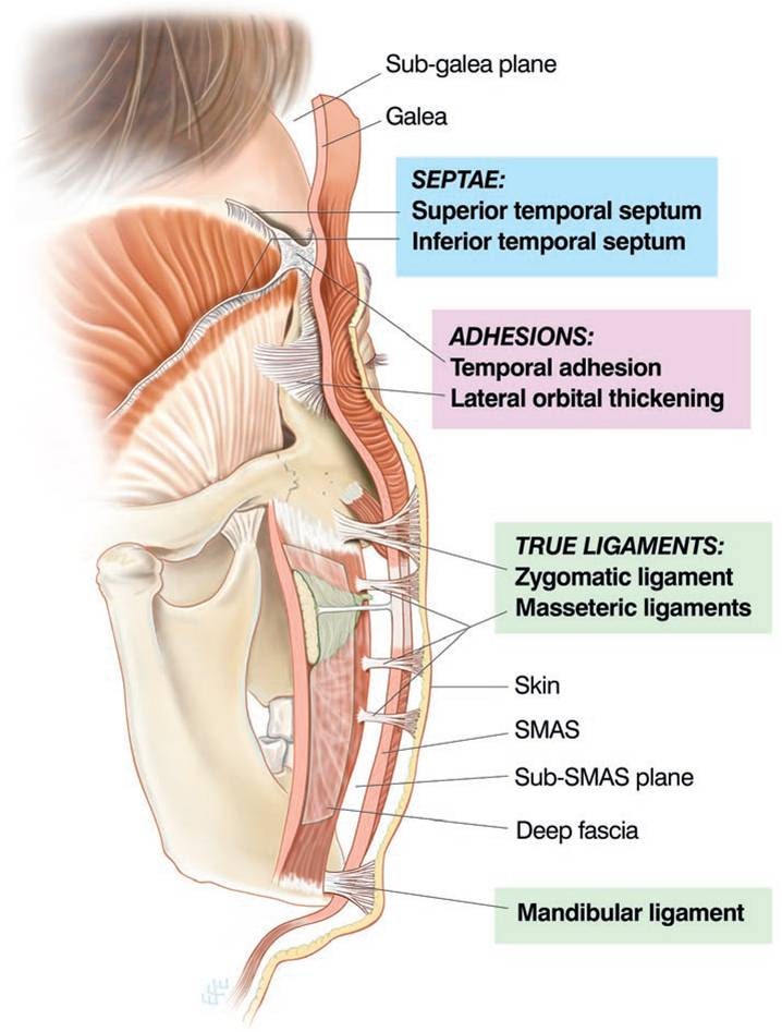 SMAS 안면거상과 Deep Plane(딥플레인) 이름만 보고 비교하면 안되는 이유 관련 이미지 1